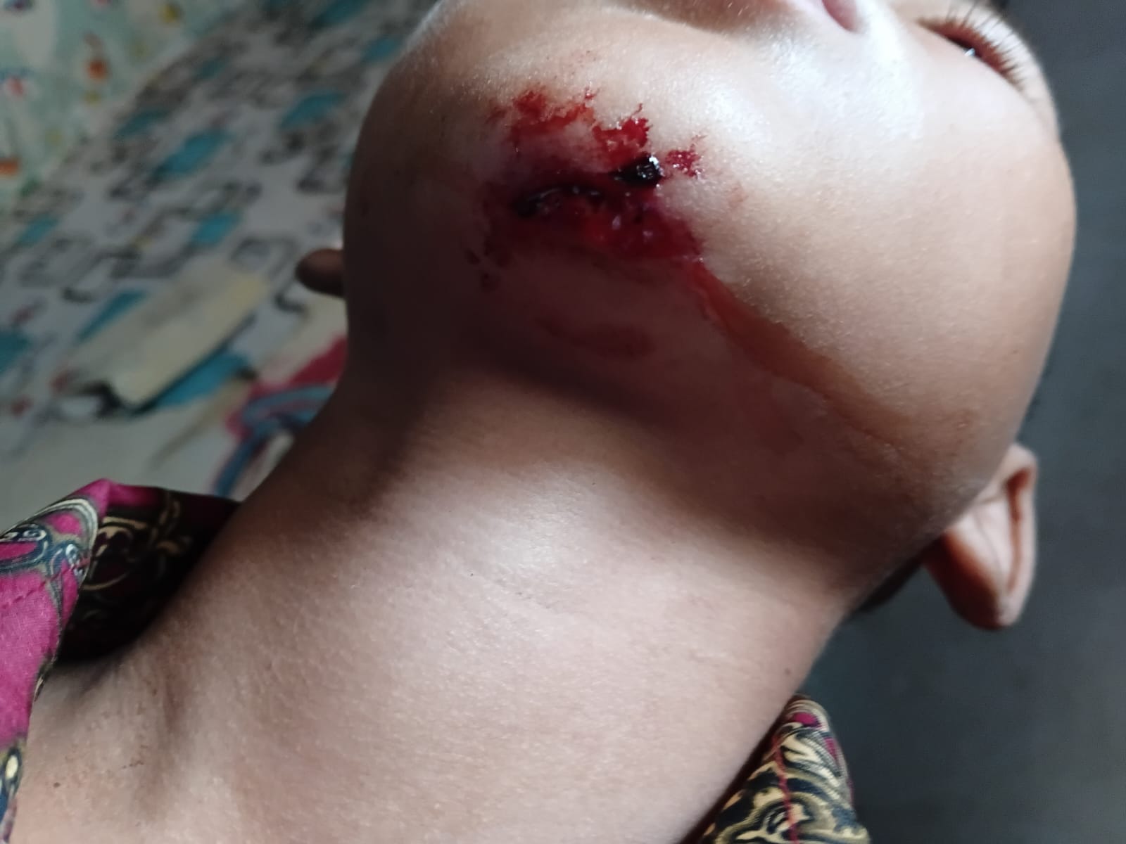 Siswa Luka Saat Jam Sekolah, Pengawasan SDN Talagasari 3 Dipertanyakan — GOW-BANTEN Desak Disdikpora Turun Tangan